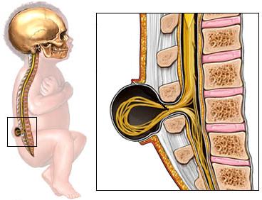 Sacral Spine Stock Photos & Pictures. Royalty Free Sacral ...